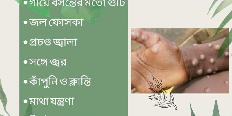 মাঙ্কি পক্স কি?