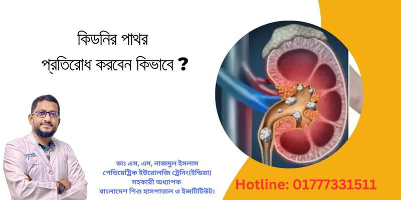 কিডনিতে পাথর প্রতিরোধ