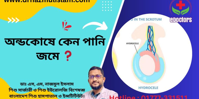 হাইড্রোসিল (Hydrocele)