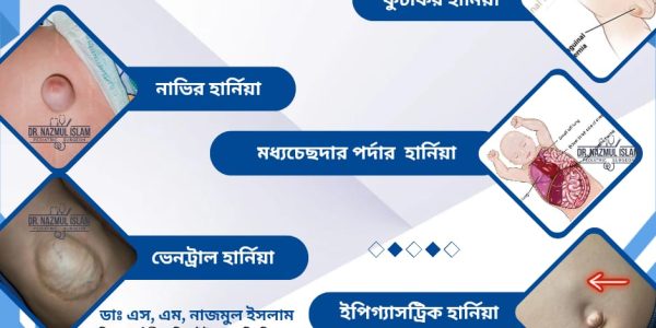 হার্নিয়া #হার্নিয়ালক্ষণ #মুসলমানি #খতনা #অন্ডকোষ #hydrocele #কুচকিরহার্নিয়া #নাভির_হার্নিয়া